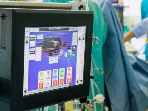 How Vivacity Perfusion Ensures Quality and Reliability in Perfusion Services